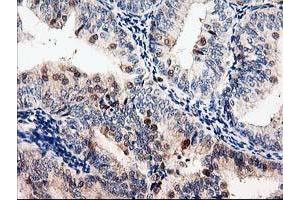 Image no. 1 for anti-Latexin (LXN) antibody (ABIN1499100) (Latexin 抗体)