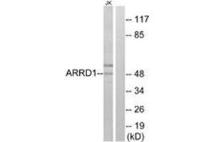 Western blot analysis of extracts from Jurkat cells, using ARRD1 Antibody.