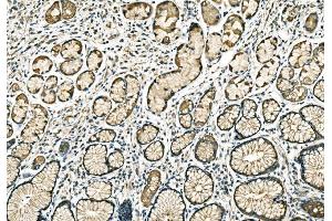 IHC analysis of PPFIA1 using anti-PPFIA1 antibody (ABIN7600454).