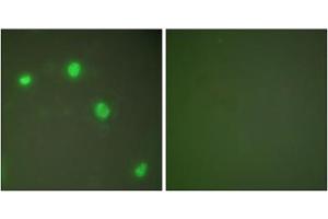 Immunofluorescence analysis of COS7 cells, using Ku70 antibody (ABIN5976448). (XRCC6 抗体  (C-Term))