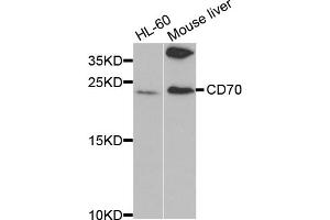 Western blot analysis of extracts of various cell lines, using CD70 antibody (ABIN5971064) at 1/1000 dilution. (CD70 抗体)