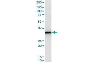 SHBG polyclonal antibody (A01), Lot # 051011JC01. (SHBG 抗体  (AA 41-140))