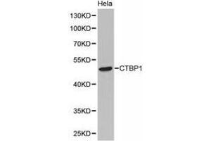 Western Blotting (WB) image for anti-C-terminal Binding Protein 1 (CTBP1) antibody (ABIN1872058) (CTBP1 抗体)
