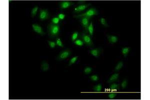 Immunofluorescence of monoclonal antibody to GABPA on HeLa cell. (GABPA 抗体  (AA 1-100))