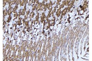 Immunohistochemistry (IHC) image for anti-Hydroxyacyl-Coenzyme A Dehydrogenase/3-Ketoacyl-Coenzyme A Thiolase/enoyl-Coenzyme A Hydratase (Trifunctional Protein), alpha Subunit (HADHA) (C-Term) antibody (ABIN6262145)