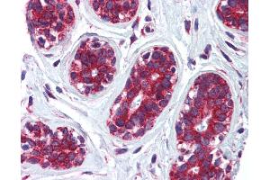 Immunohistochemistry (IHC) image for anti-Cytoskeleton-Associated Protein 4 (CKAP4) (Middle Region) antibody (ABIN2782739) (CKAP4 抗体  (Middle Region))