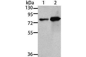 Western Blot analysis of 293T and A431 cell using MSN Polyclonal Antibody at dilution of 1:500 (Moesin 抗体)