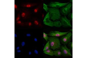 ABIN6265557 and ABIN6278407 staining  cells by IF/ICC. (THOC1 抗体  (C-Term))