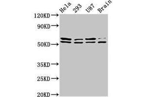 Western Blot Positive WB detected in: Hela whole cell lysate, 293 whole cell lysate, U87 whole cell lysate, Rat brain tissue All lanes: CD3EAP antibody at 3. (CD3EAP 抗体  (AA 289-404))
