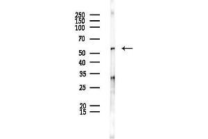 anti-DEAD (Asp-Glu-Ala-Asp) Box Polypeptide 6 (DDX6) (C-Term) antibody