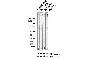 Western blot analysis of Phospho-SHP-1 (Tyr536) expression in various lysates