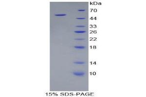 SDS-PAGE (SDS) image for Kallikrein 8 (KLK8) (AA 33-250) protein (His tag,GST tag) (ABIN1879805) (Kallikrein 8 Protein (KLK8) (AA 33-250) (His tag,GST tag))