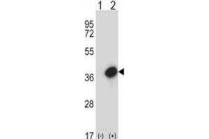 Western Blotting (WB) image for anti-General Transcription Factor IIE, Polypeptide 2 (GTF2E2) antibody (ABIN2997737) (GTF2E2 抗体)