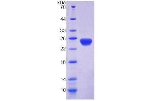 SDS-PAGE (SDS) image for Discs, Large Homolog 5 (DLG5) (AA 1722-1905) protein (His tag) (ABIN6239241)