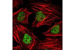 Confocal immunofluorescence analysis of Hela cells using HDAC3 mouse mAb (green). (HDAC3 抗体  (AA 224-428))