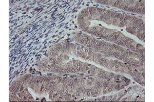 Image no. 2 for anti-Mitogen-Activated Protein Kinase Kinase 3 (MAP2K3) antibody (ABIN1499403) (MAP2K3 抗体)