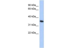 Western Blotting (WB) image for anti-MAX Interactor 1 (MXI1) antibody (ABIN2463882) (MXI1 抗体)