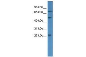 Image no. 1 for anti-Guanylate Cyclase Activator 1B (Retina) (GUCA1B) (AA 34-83) antibody (ABIN6746667) (GUCA1B 抗体  (AA 34-83))