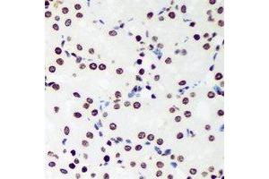 Immunohistochemical analysis of Sox-5 staining in rat kidney formalin fixed paraffin embedded tissue section. (SOX5 抗体)