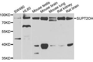 Western blot analysis of extracts of various cell lines, using SUPT20H antibody. (FAM48A/P38IP 抗体)