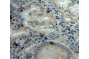 Used in DAB staining on fromalin fixed paraffin-embedded stomach tissue (DDOST 抗体  (AA 43-427))