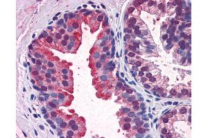Immunohistochemistry (IHC) image for anti-Kelch-Like ECH-Associated Protein 1 (KEAP1) (N-Term) antibody (ABIN2775978) (KEAP1 抗体  (N-Term))