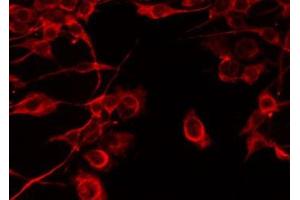 Immunofluorescence (fixed cells) (IF/ICC) image for anti-Complement Component 1, Q Subcomponent, B Chain (C1QB) (Internal Region) antibody (ABIN6260363)