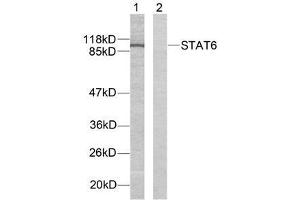 Western blot analysis of extracts from HeLa cells using STAT6 (Ab-641) antibody (E021050). (STAT6 抗体)