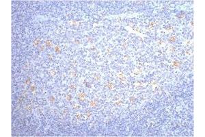 IHC staining of human tonsil tissue, diluted at 1:200. (CD68 抗体)
