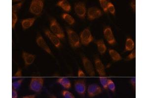 Immunofluorescence analysis of L929 cells using SEC61B Polyclonal Antibody at dilution of 1:100. (SEC61B 抗体)