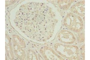 Immunohistochemistry of paraffin-embedded human kidney tissue using ABIN7173675 at dilution of 1:100 (TUBB1 抗体  (AA 270-451))