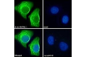 ABIN190899 Immunofluorescence analysis of paraformaldehyde fixed A549 cells, permeabilized with 0. (SLC7A11 抗体  (Internal Region))