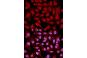 Immunofluorescence analysis of U2OS cell using MAP2K6 antibody. (MAP2K6 抗体  (AA 1-334))