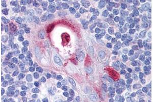 Human Thymus: Formalin-Fixed, Paraffin-Embedded (FFPE) (SPI1 抗体  (AA 1-122))