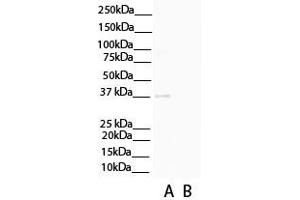WB Suggested Anti-C1QTNF3 Antibody Titration: 0. (C1QTNF3 抗体  (N-Term))