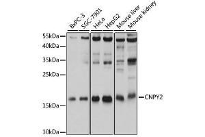 Western blot analysis of extracts of various cell lines, using CNPY2 antibody. (CNPY2/MSAP 抗体  (AA 1-182))