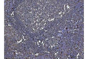 IHC analysis of HLA-DRA using anti-HLA-DRA antibody (ABIN7600950). (HLA-DRA 抗体  (AA 26-254))