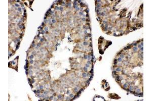 IHC analysis of IDH1 using anti-IDH1 antibody (ABIN3043855).