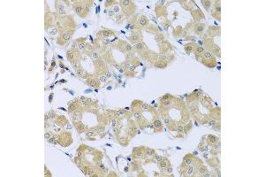 Immunohistochemistry of paraffin-embedded human stomach using SYT4 antibody at dilution of 1:100 (x40 lens). (SYT4 抗体)