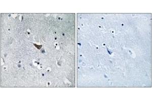 Immunohistochemistry analysis of paraffin-embedded human brain tissue, using GluR1 (Ab-849) Antibody. (Glutamate Receptor 1 抗体  (AA 816-865))