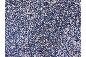 Immunohistochemical staining of paraffin-embedded Human lymph node tissue using anti-ANKRD53 mouse monoclonal antibody. (ANKRD53 抗体  (AA 1-300))
