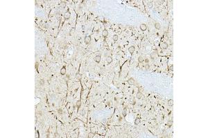Immunohistochemistry (IHC) image for anti-Dual Specificity Phosphatase 6 (DUSP6) (AA 1-170) antibody (ABIN3017521)