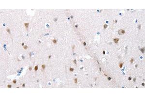 Immunohistochemistry of paraffin-embedded Human brain using POMC Polyclonal Antibody at dilution of 1:30 (POMC 抗体)
