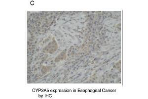 Immunohistochemistry (IHC) image for anti-Cytochrome P450, Family 3, Subfamily A, Polypeptide 5 (CYP3A5) (C-Term) antibody (ABIN307112)