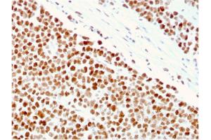 Formalin-fixed, paraffin-embedded human Small Intestine stained with MSH6 Mouse Monoclonal Antibody (MSH6/3086). (MSH6 抗体  (AA 374-540))