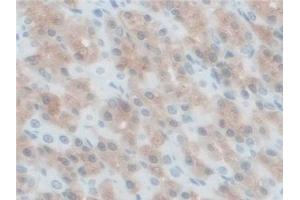 Immunohistochemistry (IHC) image for anti-Branched Chain Ketoacid Dehydrogenase Kinase (BCKDK) (AA 44-223) antibody (ABIN7436711)