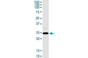 ARHGDIA MaxPab rabbit polyclonal antibody. (ARHGDIA 抗体  (AA 1-204))