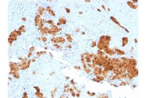 Immunohistochemistry (IHC) image for anti-Calbindin 2 (CALB2) (AA 23-242) antibody (ABIN6940931)