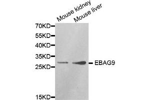 Western blot analysis of extracts of various cell lines, using EBAG9 antibody. (RCAS1 抗体)