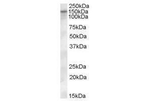Image no. 1 for anti-Solute Carrier Family 12 (Potassium-Chloride Transporter) Member 4 (SLC12A4) (Internal Region) antibody (ABIN374882) (SLC12A4 抗体  (Internal Region))